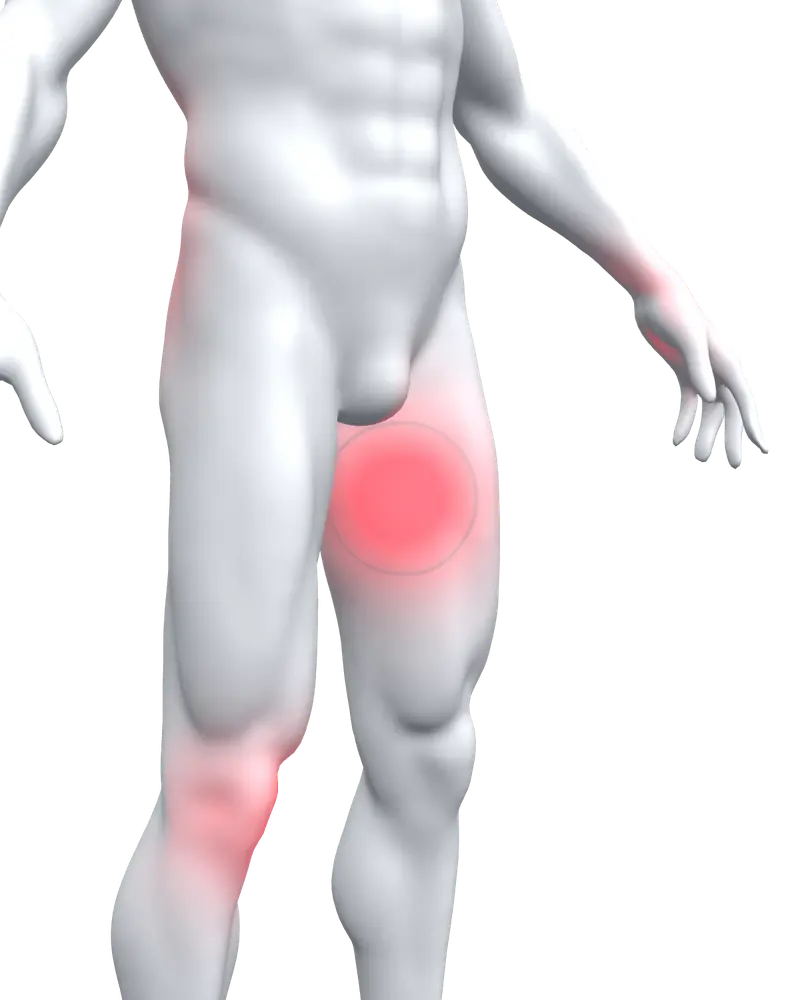 Left inner thigh highlighted in red